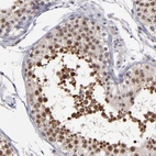 Immunohistochemical staining of human testis shows high expression.