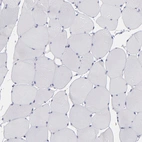 Immunohistochemical staining of human skeletal muscle shows low expression as expected.