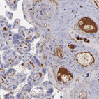 Anti-C1QA Antibody