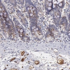 Immunohistochemical staining of human duodenum shows strong positivity in plasma.