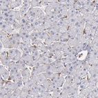 Immunohistochemical staining of human liver shows moderate cytoplasmic positivity in Kupffer cells.