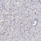 Immunohistochemical staining of human liver shows moderate cytoplasmic positivity in Kupffer cells.