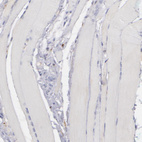 Immunohistochemical staining of human skeletal muscle shows no positivity in striated muscle fibers as expected.
