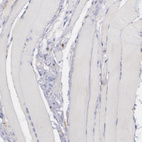 Anti-C1QA Antibody