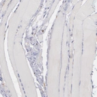 Immunohistochemical staining of human skeletal muscle shows no positivity in striated muscle fibers as expected.