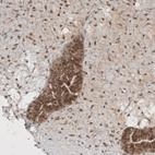 Anti-PUM3 Antibody