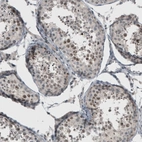 Immunohistochemical staining of human testis shows weak to moderate positivity in nucleoli in cells in seminiferous ducts.