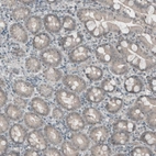 Immunohistochemical staining of human colon shows weak to moderate positivity in nucleoli in glandular cells.