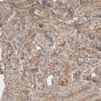 Immunohistochemical staining of human kidney shows weak to moderate positivity in nucleoli in cells in tubules.