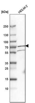 Western blot analysis in human cell line HDLM-2.