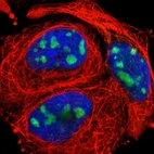 Immunofluorescent staining of human cell line A-431 shows localization to nucleoli.