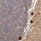 Anti-BTG2 Antibody