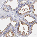 Anti-BTG2 Antibody