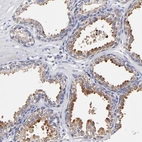 Immunohistochemical staining of human prostate shows moderate cytoplasmic positivity in glandular cells.
