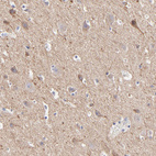 Immunohistochemical staining of human cerebral cortex shows moderate cytoplasmic positivity in neuropil.