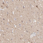 Immunohistochemical staining of human cerebral cortex shows moderate cytoplasmic positivity in neuropil.