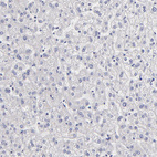 Anti-BTG2 Antibody