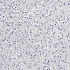 Immunohistochemical staining of human liver shows no positivity in hepatocytes as expected.