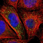 Immunofluorescent staining of human cell line A-431 shows localization to vesicles.