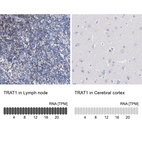 Anti-TRAT1 Antibody