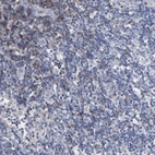 Immunohistochemical staining of human lymph node shows high expression.