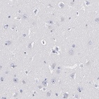 Immunohistochemical staining of human cerebral cortex shows low expression as expected.