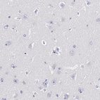 Anti-TRAT1 Antibody