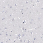 Immunohistochemical staining of human cerebral cortex shows low expression as expected.