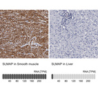 Anti-SLMAP Antibody