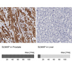 Anti-SLMAP Antibody