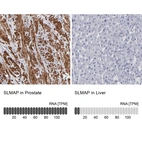 Immunohistochemistry analysis in human prostate and liver tissues using HPA002357 antibody. Corresponding SLMAP RNA-seq data are presented for the same tissues.