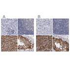 Anti-SLMAP Antibody