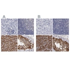 Immunohistochemical staining of human liver, lymph node, smooth muscle and testis using Anti-SLMAP antibody HPA002357 (A) shows similar protein distribution across tissues to independent antibody HPA002358 (B).