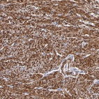 Immunohistochemical staining of human smooth muscle shows high expression.