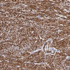 Anti-SLMAP Antibody