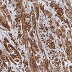 Immunohistochemical staining of human prostate shows strong cytoplasmic positivity in smooth muscle cells.