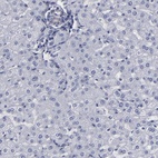 Anti-SLMAP Antibody