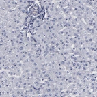 Immunohistochemical staining of human liver shows low expression as expected.