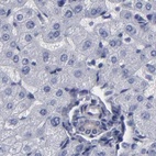 Immunohistochemical staining of human liver using Anti-SLMAP antibody HPA002357.