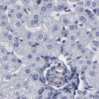 Immunohistochemical staining of human liver using Anti-SLMAP antibody HPA002357.