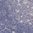 Immunohistochemical staining of human lymph node using Anti-SLMAP antibody HPA002357.