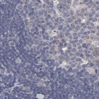Immunohistochemical staining of human lymph node using Anti-SLMAP antibody HPA002357.