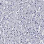 Immunohistochemical staining of human liver shows negative cytoplasmic positivity in hepatocytes as expected.