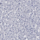 Immunohistochemical staining of human liver shows negative cytoplasmic positivity in hepatocytes as expected.