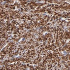 Immunohistochemical staining of human smooth muscle using Anti-SLMAP antibody HPA002357.