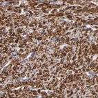 Immunohistochemical staining of human smooth muscle using Anti-SLMAP antibody HPA002357.