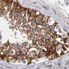 Immunohistochemical staining of human testis using Anti-SLMAP antibody HPA002357.
