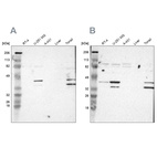 Western blot analysis using Anti-SLMAP antibody HPA002357 (A) shows similar pattern to independent antibody HPA002358 (B).
