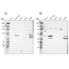 Western blot analysis using Anti-SLMAP antibody HPA002357 (A) shows similar pattern to independent antibody HPA002358 (B).