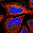 Immunofluorescent staining of human cell line U-2 OS shows localization to cytosol.